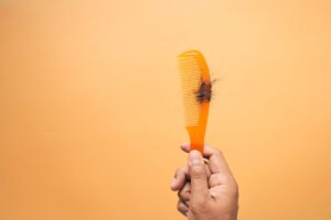 Comb with loose strands of hair representing female hair loss and hair shedding discussed by Dr. Stephanie Opusunju at Elam Health and Wellness